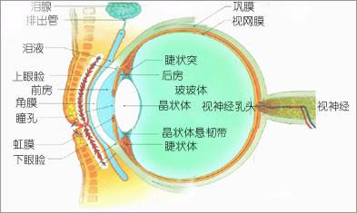 為什么會(huì)發(fā)展成高度近視？